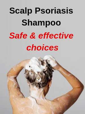 Scalp Psoriasis Shampoo buying guide